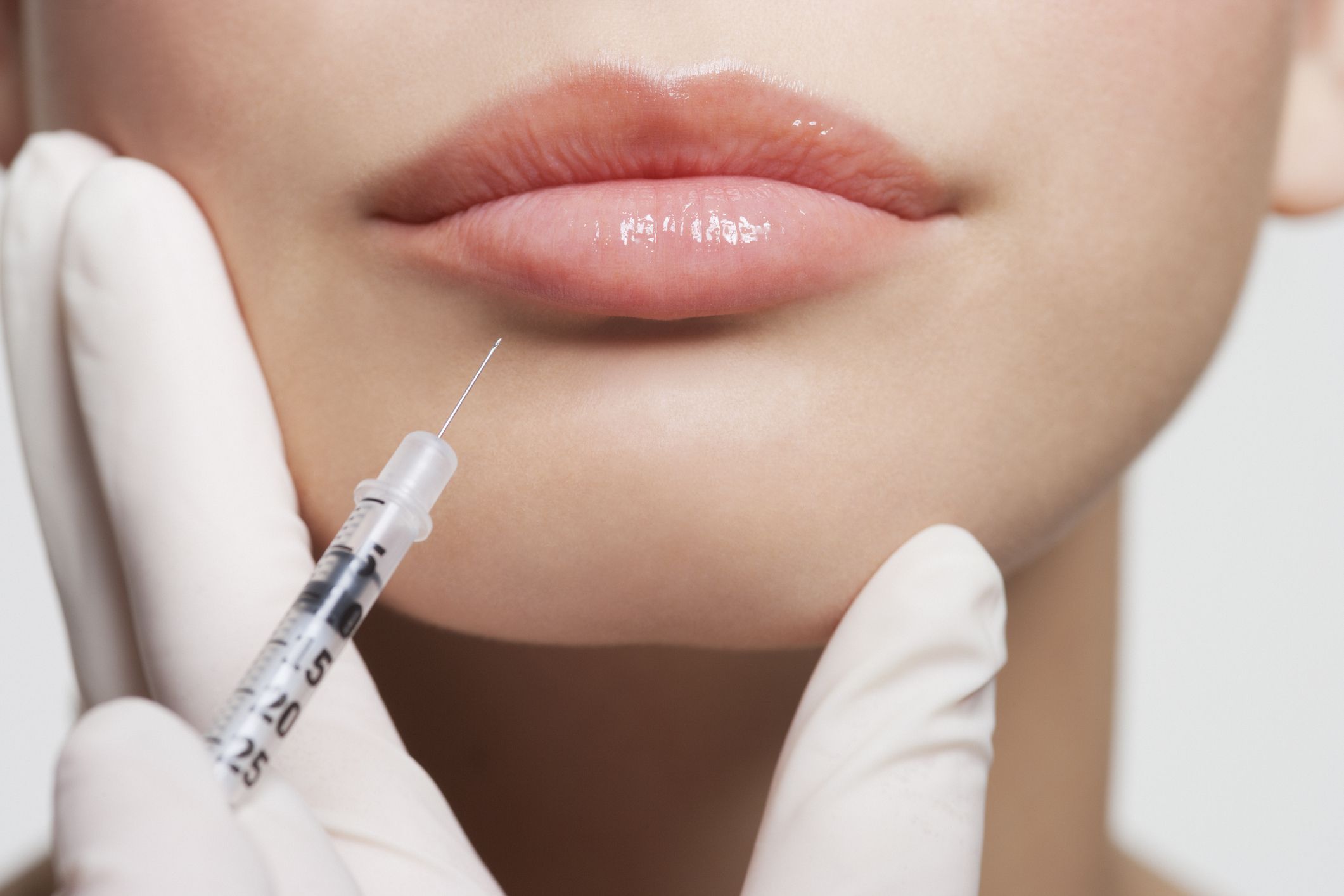 How Much are Lip Injections? (A Comprehensive Guide)